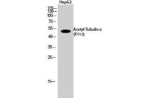 Western Blotting (WB) image for anti-alpha Tubulin (TUBA1) (acLys112) antibody (ABIN3181901) (alpha Tubulin Antikörper  (acLys112))