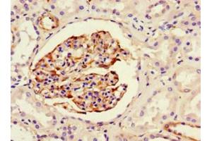 Immunohistochemistry (IHC) image for anti-Nestin (NES) antibody (ABIN7161178)
