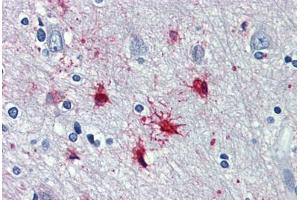 Human Brain, cortex: Formalin-Fixed, Paraffin-Embedded (FFPE) (alpha 1 Adrenergic Receptor Antikörper  (AA 206-270))