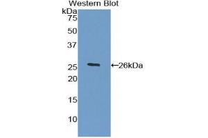 Western blot analysis of the recombinant protein. (HPSE Antikörper  (AA 54-278))