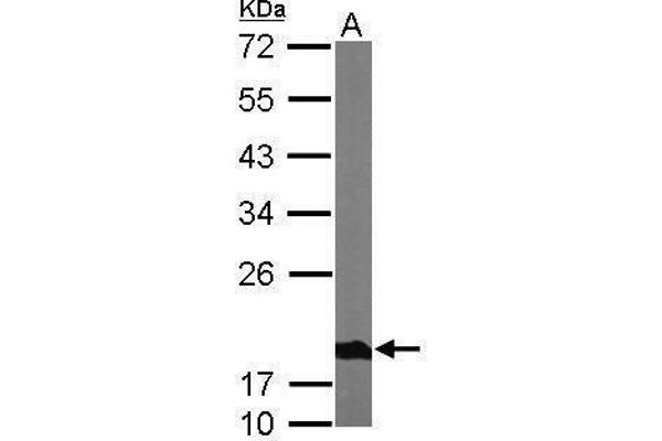 NDUFS4 Antikörper  (Center)