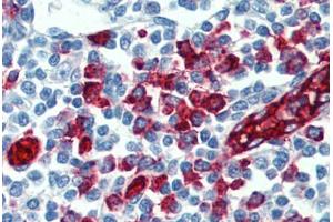 Human Tonsil: Formalin-Fixed, Paraffin-Embedded (FFPE) (SELPLG Antikörper)