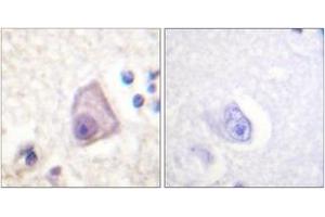 Immunohistochemistry analysis of paraffin-embedded human brain, using SEK1/MKK4/JNKK1 (Phospho-Ser257) Antibody. (MAP2K4 Antikörper  (pSer257))