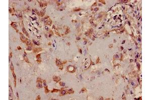 Immunohistochemistry of paraffin-embedded human placenta tissue using ABIN7173361 at dilution of 1:100 (TRIB2 Antikörper  (AA 204-337))