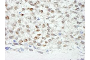 Immunohistochemistry (IHC) image for anti-Zinc Finger Protein 318 (Znf318) (AA 2049-2099) antibody (ABIN7449041)