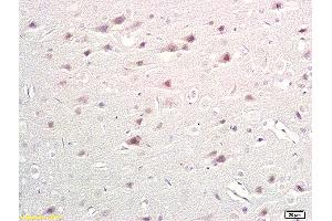 Formalin-fixed and paraffin embedded rat brain labeled with Anti-TPH/Trptophan Hydroxylase Polyclonal Antibody, Unconjugated (ABIN673509) at 1:200 followed by conjugation to the secondary antibody and DAB staining. (Trptophan Hydroxylase (AA 31-150) Antikörper)