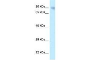 Image no. 1 for anti-Protein Phosphatase 6, Regulatory Subunit 3 (PPP6R3) (AA 201-250) antibody (ABIN6747776) (PPP6R3 Antikörper  (AA 201-250))