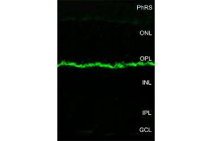 Immunohistochemistry (IHC) image for anti-Membrane Protein, Palmitoylated 4 (MAGUK P55 Subfamily Member 4) (MPP4) (AA 197-216) antibody (ABIN1742448)