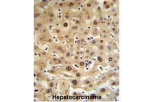 Immunohistochemistry (IHC) image for anti-Hemopexin (HPX) antibody (ABIN3002733) (Hemopexin Antikörper)
