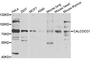 Western blot analysis of extracts of various cell lines, using CALCOCO1 antibody (ABIN5975736) at 1/1000 dilution. (CALCOCO1 Antikörper)