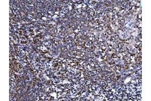 IHC analysis of SPT5/SUPT5H using anti-SPT5/SUPT5H antibody (ABIN7601985). (SUPT5H Antikörper  (AA 533-1087))