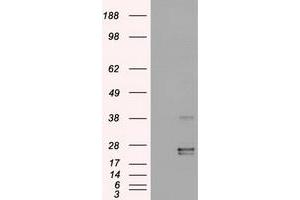 HEK293T cells were transfected with the pCMV6-ENTRY control (Left lane) or pCMV6-ENTRY OSM (Right lane) cDNA for 48 hrs and lysed. (Oncostatin M Antikörper  (AA 25-252))