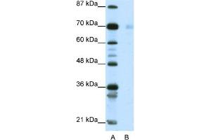 WB Suggested Anti-HSP90AB1 Antibody Titration:  1. (HSP90AB1 Antikörper  (C-Term))