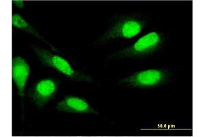 Immunofluorescence of monoclonal antibody to MNDA on HeLa cell. (MNDA Antikörper  (AA 311-407))