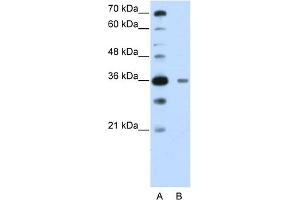 WB Suggested Anti-DAZAP1 Antibody Titration:  0. (DAZAP1 Antikörper  (C-Term))