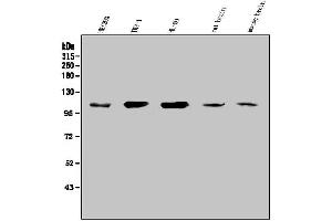 Western blot analysis of SEZ6L using anti-SEZ6L antibody (ABIN7602260). (SEZ6L Antikörper  (AA 662-953))