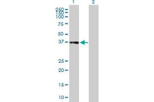 Western Blot analysis of CFHR1 expression in transfected 293T cell line by CFHR1 MaxPab polyclonal antibody. (CFHR1 Antikörper  (AA 19-330))