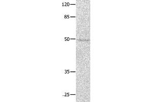 Western blot analysis of Jurkat cell, using NAP1L1 Polyclonal Antibody at dilution of 1:650 (NAP1L1 Antikörper)