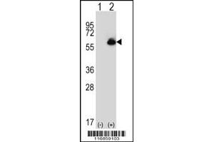Western blot analysis of ALDH4A1 using rabbit polyclonal ALDH4A1 Antibody using 293 cell lysates (2 ug/lane) either nontransfected (Lane 1) or transiently transfected (Lane 2) with the ALDH4A1 gene. (ALDH4A1 Antikörper  (C-Term))