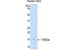 Western blot analysis of the recombinant protein. (KRT81 Antikörper  (AA 142-257))