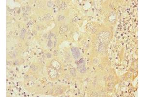 Immunohistochemistry (IHC) image for anti-Protein Kinase, CAMP-Dependent, Regulatory, Type I, beta (PRKAR1B) (AA 190-290), (Regulatory Subunit) antibody (ABIN7146619)