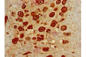 Immunohistochemistry of paraffin-embedded human placenta tissue using ABIN7156860 at dilution of 1:100 (IL22RA2 Antikörper  (AA 22-263))