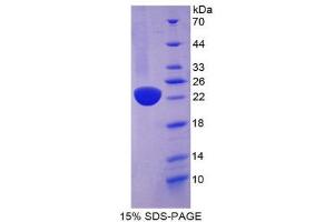 SDS-PAGE (SDS) image for Regenerating Islet-Derived 1 beta (REG1B) (AA 23-166) protein (His tag) (ABIN1878679)