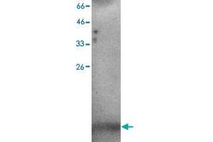 Western blot analysis of H520 whole cell lystae with C3orf10 monoclonal antibody, clone 37  at 1:500 dilution. (BRK1 Antikörper)