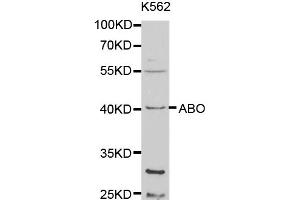 Western blot analysis of extracts of K-562 cells, using ABO antibody (ABIN5970766) at 1/1000 dilution. (ABO Antikörper)