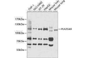 Western blot analysis of extracts of various cell lines, using PLG4A antibody (ABIN3020970, ABIN3020971, ABIN3020972 and ABIN6213833) at 1:1000 dilution. (PLA2G4A Antikörper  (AA 1-180))