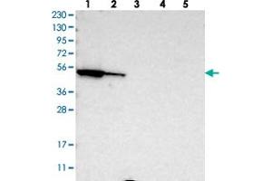 Western blot analysis of Lane 1: RT-4, Lane 2: U-251 MG, Lane 3: Human Plasma, Lane 4: Liver, Lane 5: Tonsil with FAR1 polyclonal antibody .