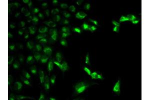 Immunofluorescence analysis of MCF-7 cell using FCGR1A antibody. (FCGR1A Antikörper)