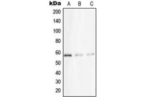 Western blot analysis of STK33 expression in A431 (A), Jurkat (B), HeLa (C) whole cell lysates. (STK33 Antikörper  (N-Term))