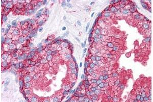 Human Prostate: Formalin-Fixed, Paraffin-Embedded (FFPE) (CD9 Antikörper)