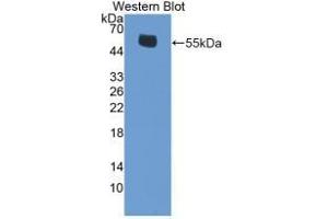 Detection of Recombinant ERb, Mouse using Polyclonal Antibody to Estrogen Receptor Beta (ERb) (ESR2 Antikörper  (AA 46-530))