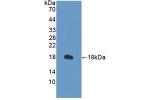 Western blot analysis of recombinant Mouse PRDX2. (Peroxiredoxin 2 Antikörper  (AA 6-164))