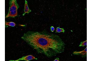 Indirect immunostaining of Hela cells with anti-syntaxin 4 (dilution 1 : 100; red) and mouse anti-α-tubulin (cat.