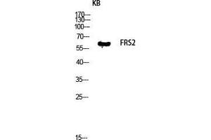 Western Blot (WB) analysis of KB lysis using FRS2 antibody. (FRS2 Antikörper  (Tyr580))