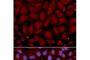 Immunofluorescence analysis of U2OS cells using BCHE Polyclonal Antibody (Butyrylcholinesterase Antikörper)