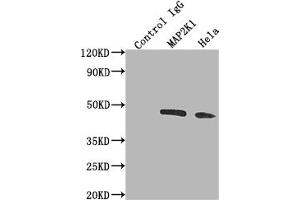 Immunoprecipitating MAP2K1 in Hela whole cell lysate Lane 1: Rabbit control IgG instead of ABIN7127612 in Hela whole cell lysate. (Rekombinanter MEK1 Antikörper)