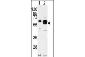 Western blot analysis of CK1G (arrow) using rabbit polyclonal CK1G Antibody (C-term) (R). (CAMK1G Antikörper  (C-Term))