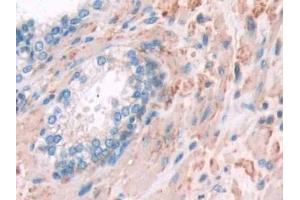 Detection of FLNa in Human Prostate Tissue using Polyclonal Antibody to Filamin A Alpha (FLNa)