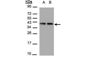 WB Image Sample(30 μg of whole cell lysate) A:A431, B:H1299 12% SDS PAGE antibody diluted at 1:1500 (TBCC Antikörper)