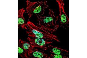 Immunofluorescence (IF) image for anti-T Antigen antibody (ABIN3001361) (T Antigen Antikörper)