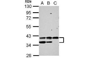 WB Image Sample (30 ug of whole cell lysate) A: 293T B: A431 C: HepG2 10% SDS PAGE antibody diluted at 1:1000 (VEGFA Antikörper  (C-Term))