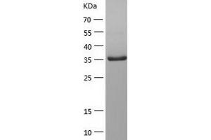 Western Blotting (WB) image for Protein tyrosine Phosphatase, Non-Receptor Type 7 (PTPN7) (AA 1-360) protein (His tag) (ABIN7124682)