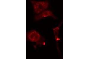 ABIN6277179 staining  Hela cells by IF/ICC. (DLGAP5 Antikörper  (N-Term))