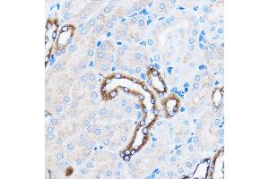 Immunohistochemistry of paraffin-embedded Mouse kidney using p38 MAPK Rabbit pAb (ABIN7268615) at dilution of 1:100 (40x lens). (MAPK14 Antikörper  (AA 1-360))