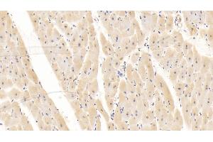 Detection of CD40L in Human Cardiac Muscle Tissue using Monoclonal Antibody to Cluster Of Differentiation 40 Ligand (CD40L) (CD40 Ligand Antikörper  (AA 180-261))