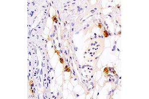 Immunohistochemistry of paraffin embedded rat thyroid gland using Calcitonin (ABIN7073271) at dilution of 1:700 (400x lens) (Calcitonin Antikörper)